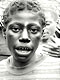 Filed teeth (Baka Pygmies, Cameroon)